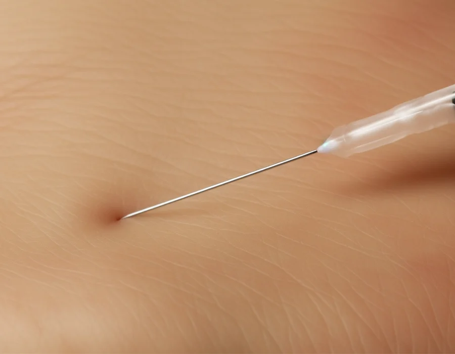 A needle injecting the skin